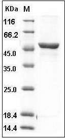 Rat GPT1 / GPT Protein (His Tag) SDS-PAGE