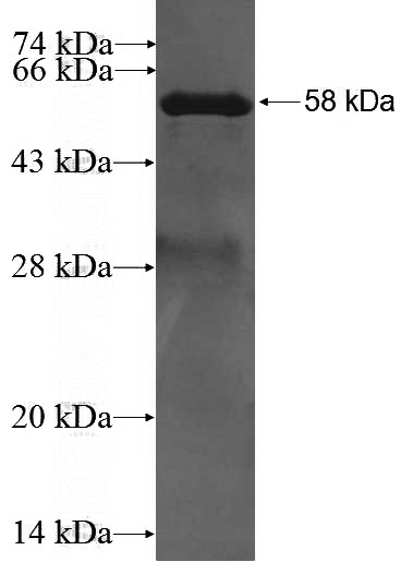 Recombinant Human HAX1 SDS-PAGE