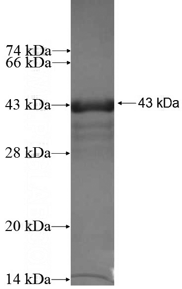 Recombinant Human JUP SDS-PAGE