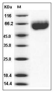 Mouse Axl Kinase Protein (His Tag) SDS-PAGE