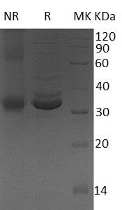 Human GPD1 (His tag) recombinant protein