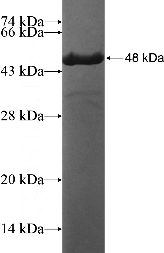 Recombinant Human LOH12CR1 SDS-PAGE