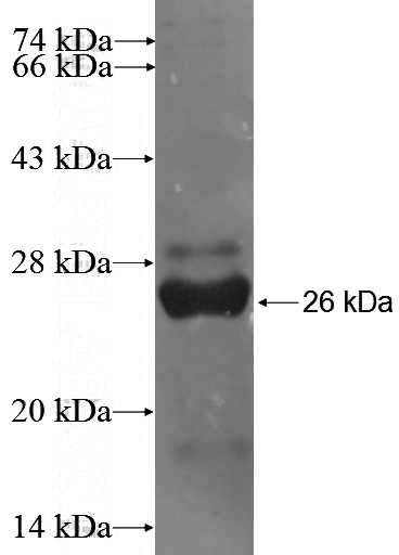 Recombinant Human RFC5 SDS-PAGE