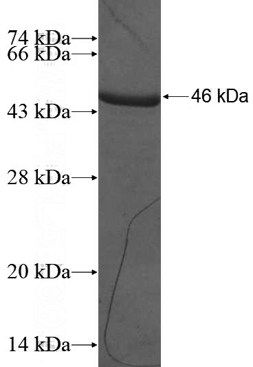 Recombinant Human CABYR SDS-PAGE