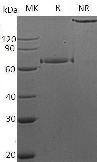 Human ERBB3/HER3 (Fc tag) recombinant protein