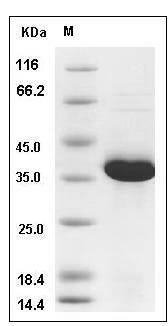 Human DEP1 / PTPRJ Protein (aa 997-1337, His Tag) SDS-PAGE
