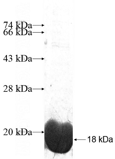 Recombinant Human LSM3 SDS-PAGE
