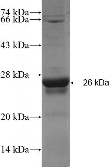 Recombinant Human FEZF2 SDS-PAGE
