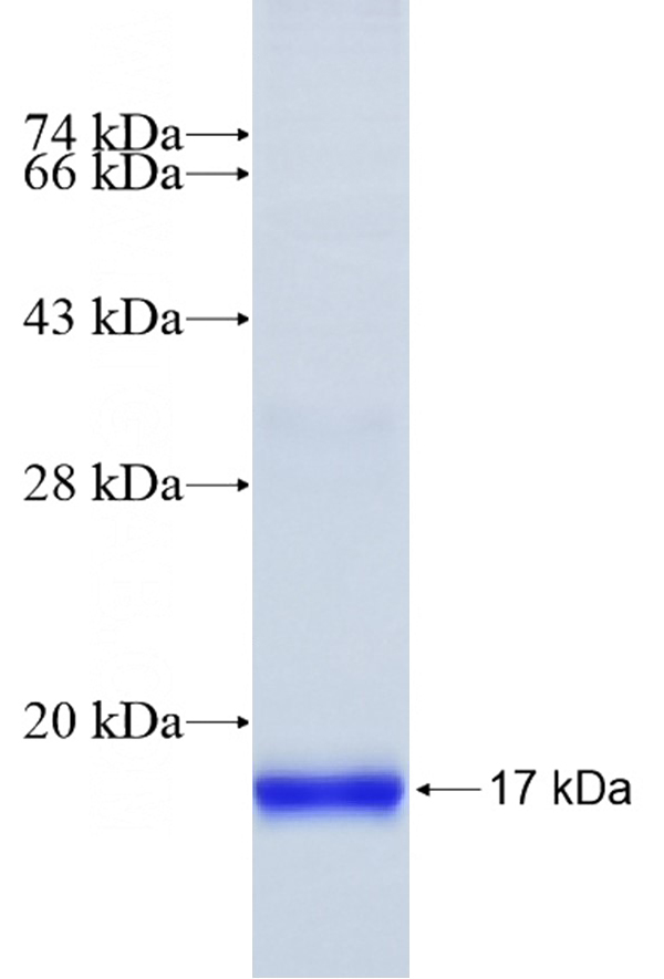 Recombinant Human SLC15A4 SDS-PAGE