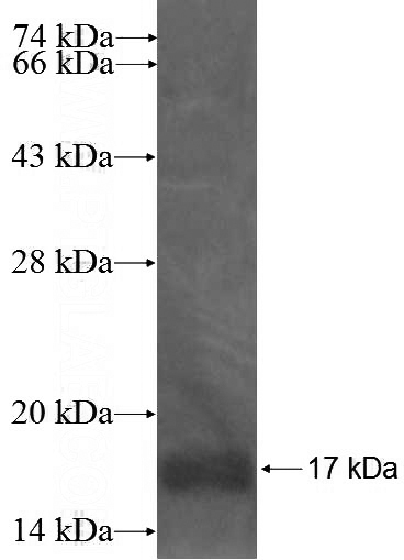 Recombinant Human SOX15 SDS-PAGE