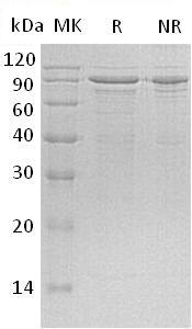 Human MECP2 (His tag) recombinant protein