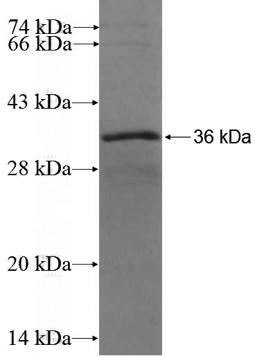Recombinant Human IGFBP2 SDS-PAGE