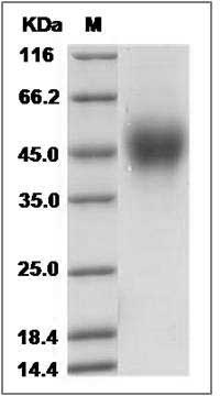 Rat CD150 / SLAM / SLAMF1 Protein (His Tag) SDS-PAGE