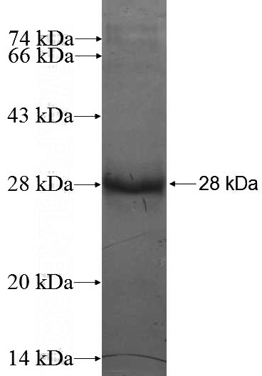 Recombinant Human RNF141 SDS-PAGE