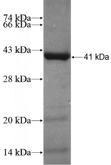 Recombinant Human ANAPC5 SDS-PAGE