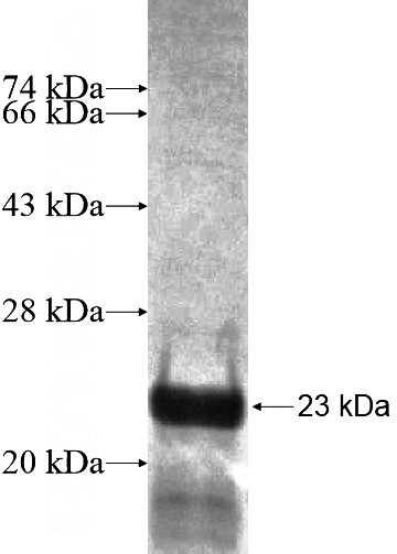 Recombinant Human KIAA1191 SDS-PAGE