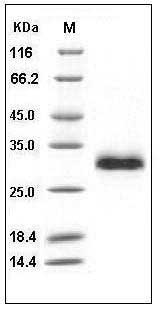 Human TIMP-1 / TIMP1 Protein (His Tag) SDS-PAGE