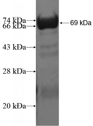 Recombinant Human ADAP1 SDS-PAGE