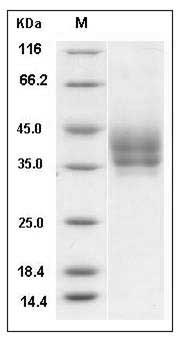 Mouse B7-DC / PD-L2 / CD273 Protein (His Tag) SDS-PAGE