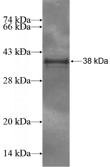 Recombinant Human C11orf49 SDS-PAGE