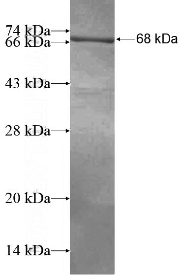 Recombinant Human VAT1 SDS-PAGE