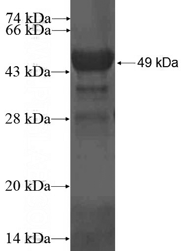 Recombinant Human GIT2 SDS-PAGE