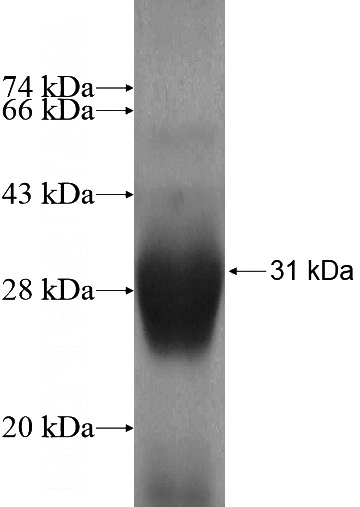 Recombinant Human DGCR6L SDS-PAGE