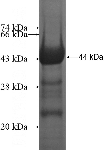 Recombinant Human LNX1 SDS-PAGE