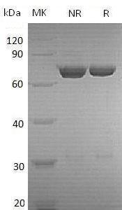 Human PGM2/MSTP006 (His tag) recombinant protein