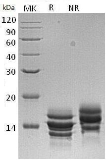 Human PPBP/CTAP3/CXCL7/SCYB7/TGB1/THBGB1 (His tag) recombinant protein