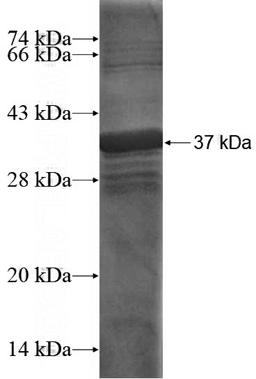 Recombinant Human SLC1A4 SDS-PAGE