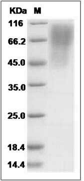 Rat CD68 (His Tag) recombinant protein