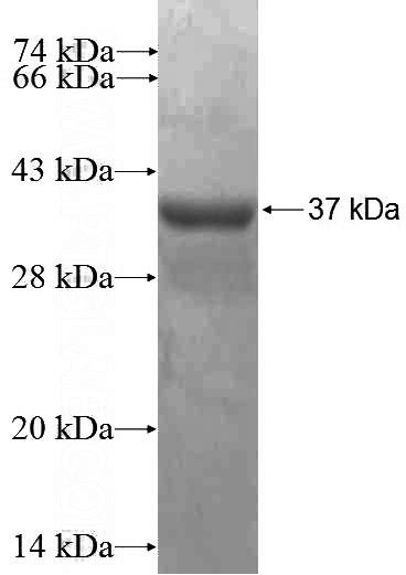 Recombinant Human SLC22A16 SDS-PAGE