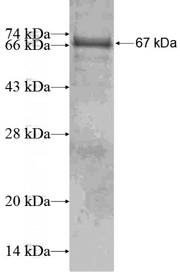 Recombinant Human MAPK11 SDS-PAGE