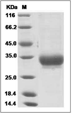 Human AMBP / Alpha 1 microglobulin Protein (His Tag) SDS-PAGE