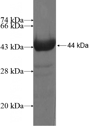 Recombinant Human FAM186B SDS-PAGE