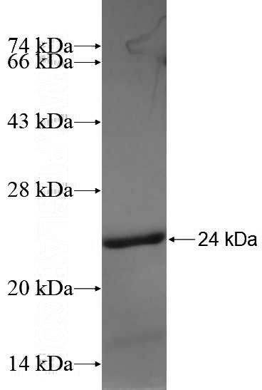Recombinant Human PLCG2 SDS-PAGE