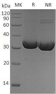Mouse Tnfsf11/Opgl/Rankl/Trance (His tag) recombinant protein