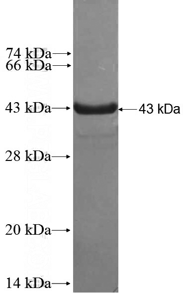 Recombinant Human TNFRSF17 SDS-PAGE