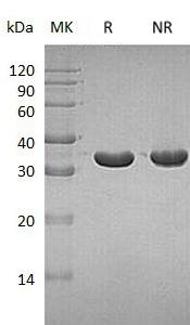 Human PTPRN/ICA3/ICA512 (His tag) recombinant protein