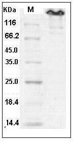 Human Contactin 3 / CNTN3 Protein (708 Asp/Asn, Fc Tag) SDS-PAGE