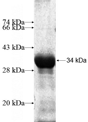 Recombinant Human NEUROD4 SDS-PAGE
