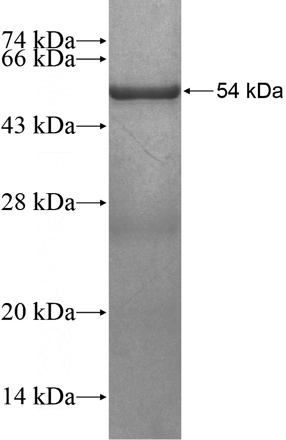 Recombinant Human ANKRD6 SDS-PAGE