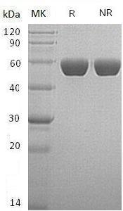 Human SERPINA1/AAT/PI/PRO0684/PRO2209 (His tag) recombinant protein