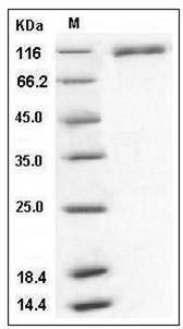 Human VCAM-1 / CD106 Protein (His Tag) SDS-PAGE