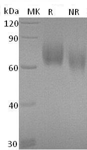 Human CD276/B7H3/PSEC0249/UNQ309/PRO352 (His tag) recombinant protein