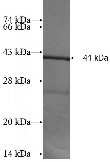 Recombinant Human HSD17B3 SDS-PAGE