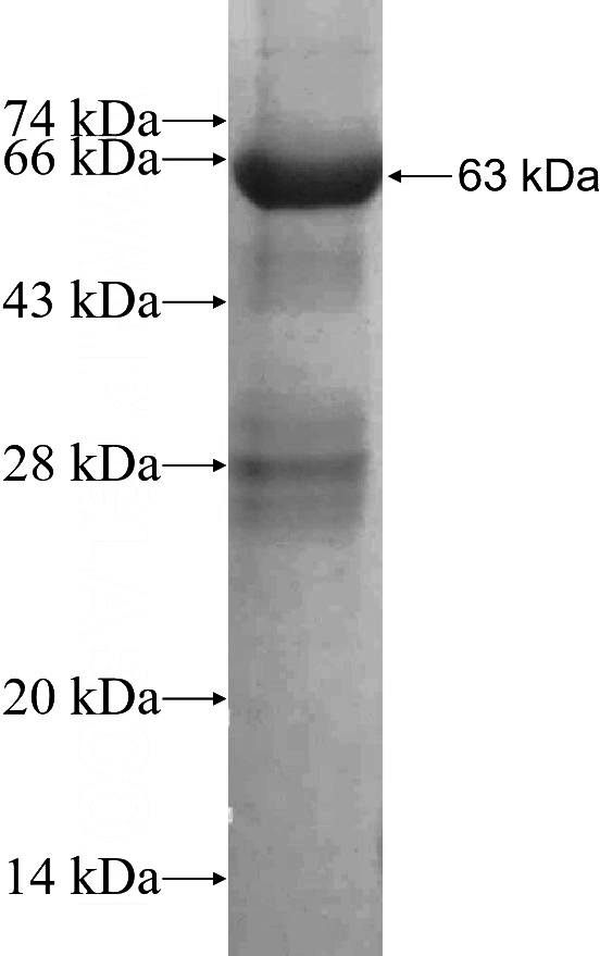 Recombinant Human API5 SDS-PAGE