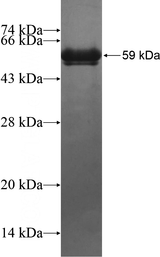 Recombinant Human DROSHA SDS-PAGE