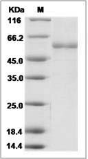 Human TIMP-1 / TIMP1 Protein (Fc Tag)